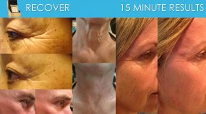 How to get rid of your wrinkles - testimonials 